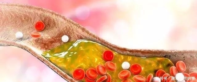  血压|收藏！最全血压、血糖、血脂标准对照表