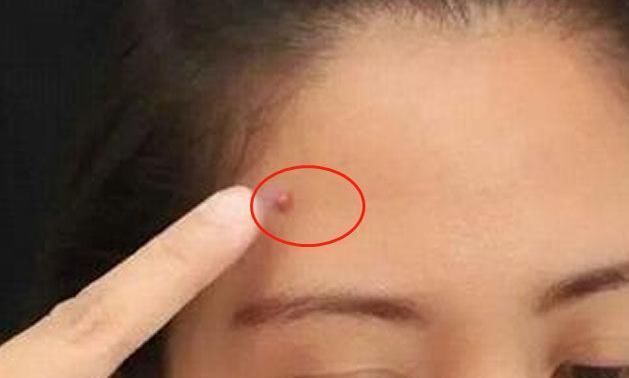 脸是子宫的“晴雨表”,若出现4大不良异常,子宫或已“稀巴烂”