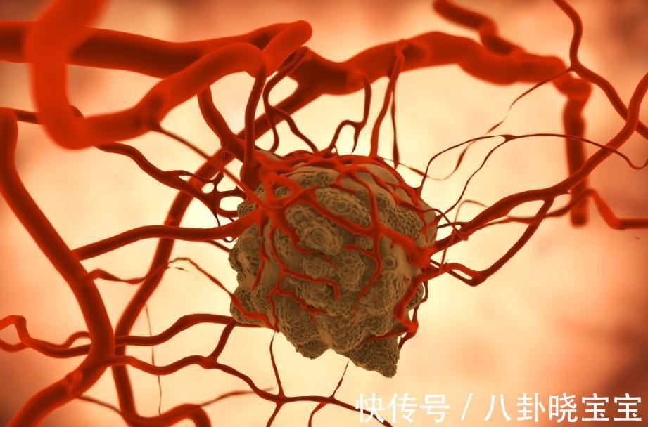 母亲|肺癌来临，睡觉先知！医生直言：肺部有癌的人，睡觉有这些表现