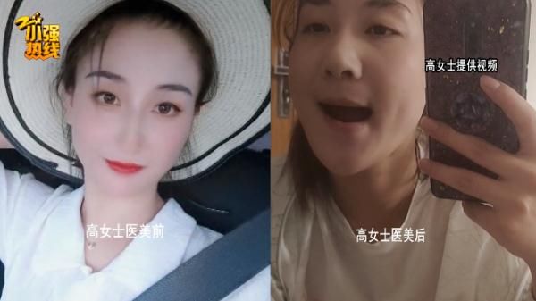 余杭区|23岁女子做医美，脸上发生奇怪变化，更不可思议的是…