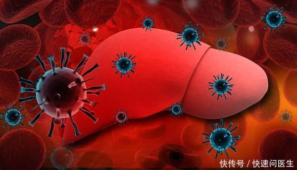 患者|2个症状提醒你同一件事:肝脏受损了,别等到了肝癌才发现