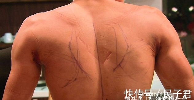 翅膀 男子花200万植入翅膀,接受120次整容手术,现与“芭比娃娃”相爱