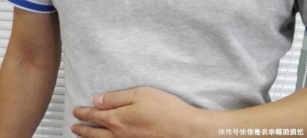 胃镜检查|胃炎演变为癌症,常有四大阶段!教你从胃镜报告上,发现癌症信号!