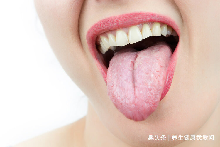 苓桂术甘汤|入夏后，教你张仲景一个方子，赶走全年湿气！脸色红润更健康！