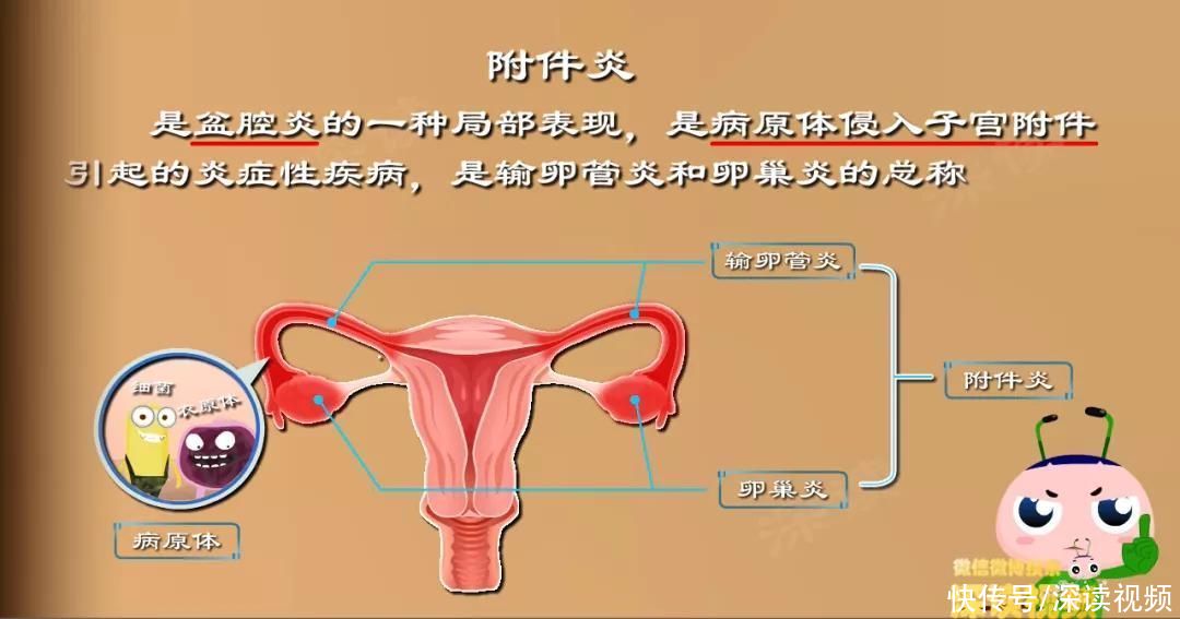 小姐姐|下腹持续隐痛？白带增多有异味？导致不孕的附件炎到底是啥样？