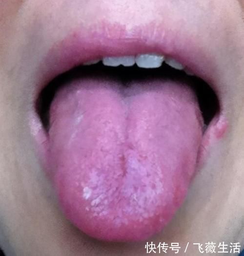 五官|五官对应五脏,身体藏着什么疾病?看脸五官就知道了