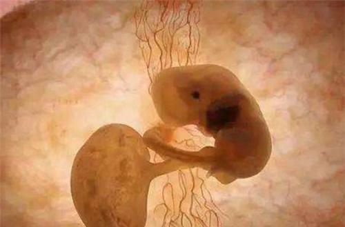 阿米莉亚|18年了,那个出生仅25厘米,曾打破世界纪录的女婴,如今已认不出