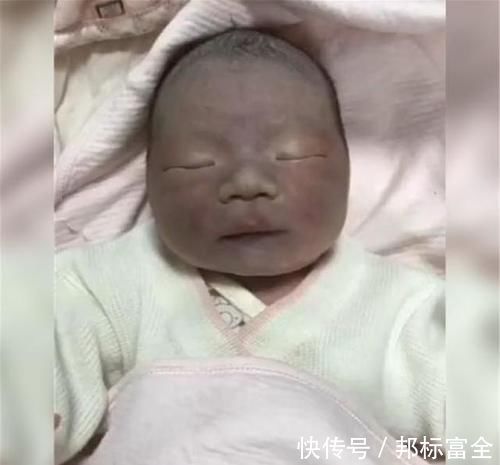 口腔|“黑脸宝宝”走红，长开后变成小帅哥，网友：还好父母忍住没扔