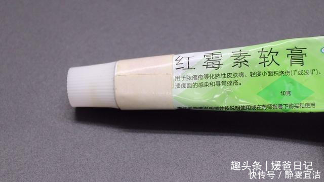 红霉素软膏的5个作用,简单实用,回家找找有没有,试试