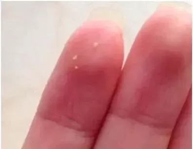 质地的眼霜|眼霜凭什么贵?脂肪粒又是如何形成的?