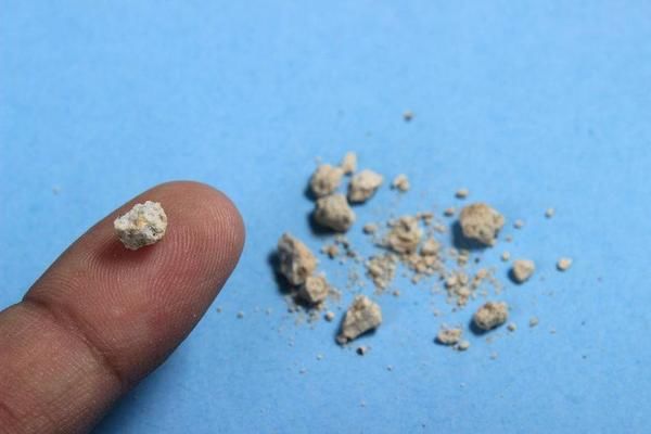 尿酸一高,全身器官受累!超标的人,这份低嘌呤食物指南请收下