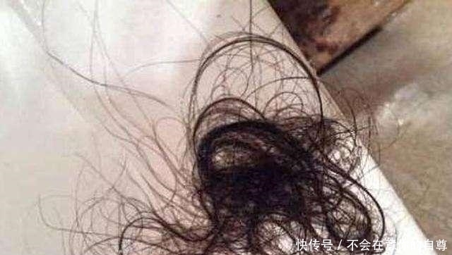 家长|12岁女孩腹痛两年,肚子里出现马蹄形状的团块,都怪家长太粗心