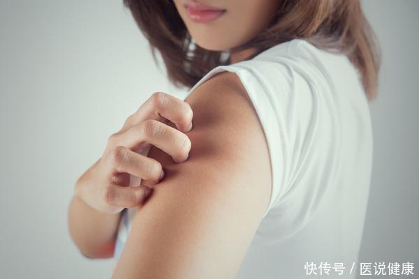 皮肤|皮肤出现这3种“怪象”,不能拖,或是糖尿病的“敲门声”!