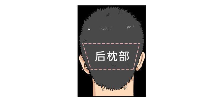 移植|揭秘植发全过程:一次植发能维持多久?哪些人不适合做?有多贵?