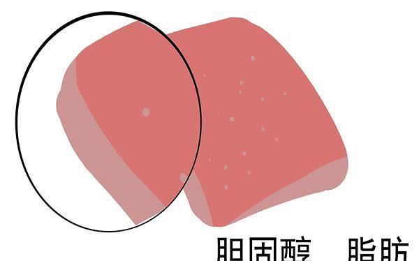 黑木耳|胆固醇的“清洁工”被找到，不是黑木耳，平时带着吃，养好血管？