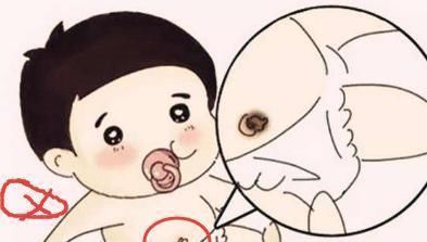 肚脐眼|宝宝两个部位越摸越聪明,三个部位不能碰,记住了吗