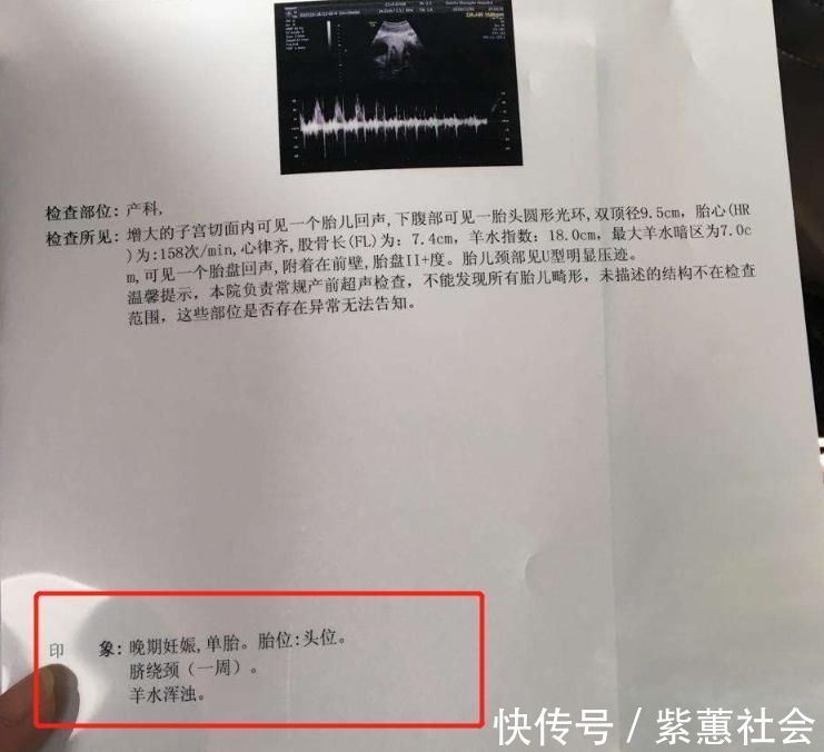 妊娠|怀孕后，4个“不良习惯”可能会让羊水变浑浊，孕妈别大意