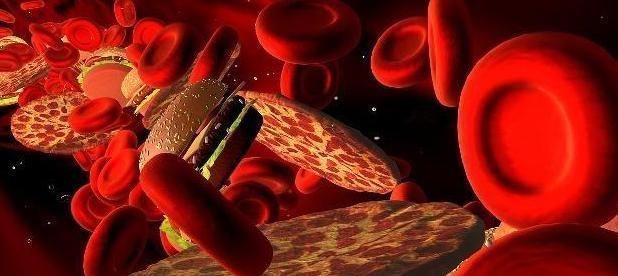 高血糖|天然“血脂药”找到了,保温杯里放两颗,血管堵塞不再愁!