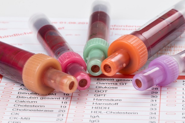 肾衰竭|4种蔬菜或是素食中的“嘌呤大户”，尿酸高的人，请尽早撤下餐桌