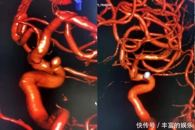 醒来|7岁男孩突然昏迷,醒来后说“妈妈,我要抱抱”