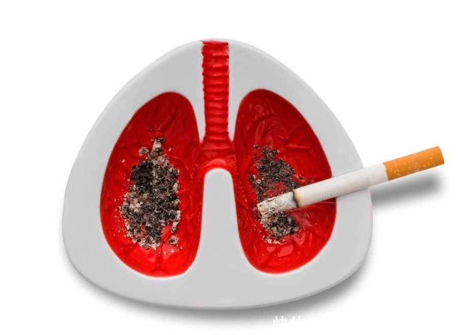 共同性|肺癌的“祸根”已找出，医生：患上肺癌的人，通常有这4个共同性