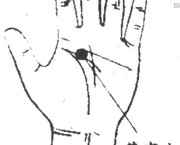 流鼻血&7把救命钥匙,老祖宗留下来的,几千年了!中老年朋友请记好!