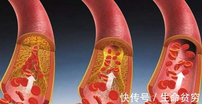 常吃花生有哪些好处,有哪些人不适合吃?看完或许会受用