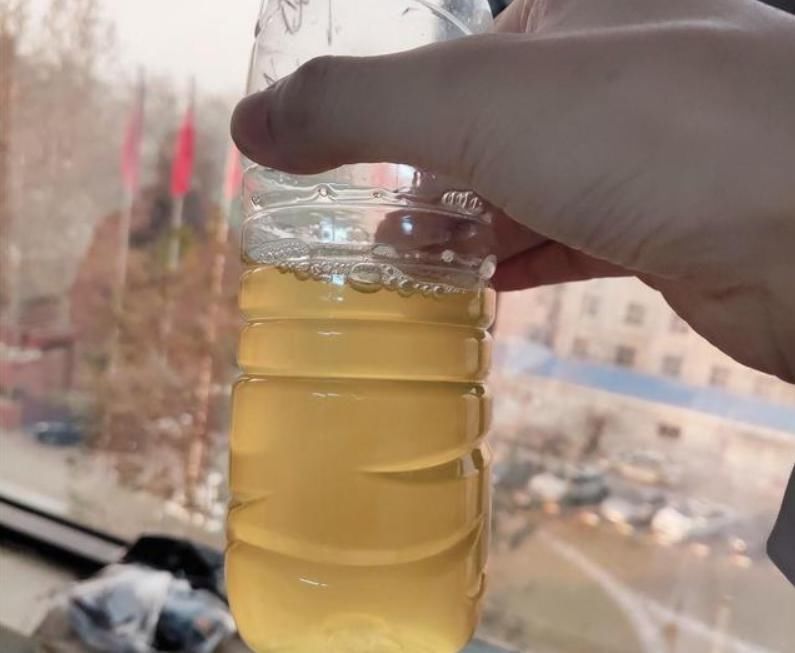  治疗|尿液是肾功能的“试金石”，3种变化，是肾病好转预兆