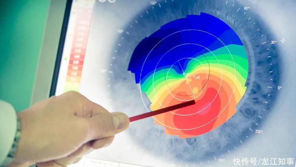角膜|近视手术该不该做?怎么选?一文给你讲清楚
