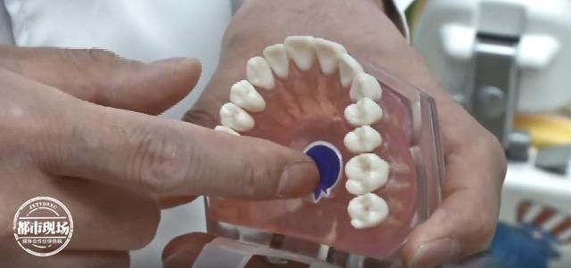 上腭|1岁女童玩玩具,贴在嘴里2个星期取下来时全是血