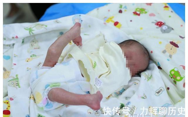 沈先涛|稀奇!宝宝出生双腿翘上天,医生没开刀成功拉直