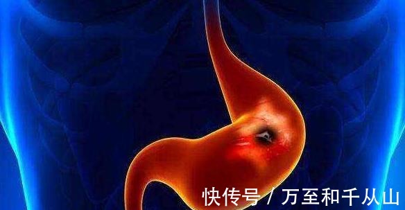 猪瘦肉|不吃米饭可诱发糖尿病,常食2种鱼类对降糖调理胰岛素有好处!