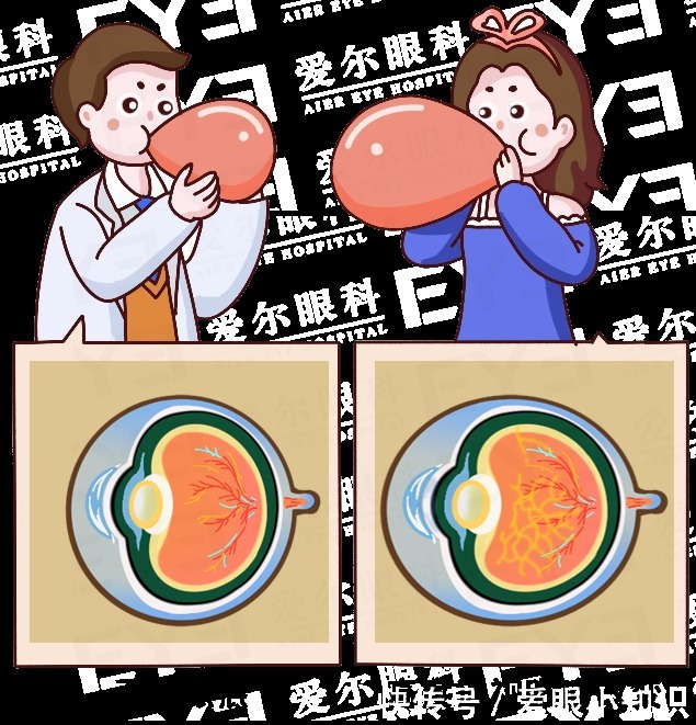 运动|近视＞600度的人，这些运动都不要做！