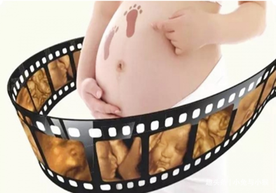 四维彩超套近乎,想得到点“关键信息”,孕妈们产检目的别错了!