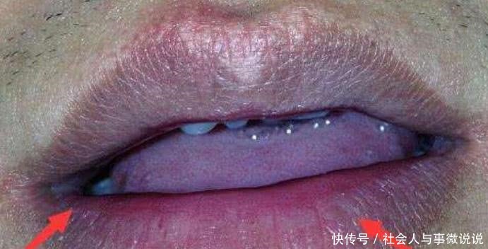 qt:levelH|“肾”不好的男生,头上会出现“3个现象”,希望你一个都没有!