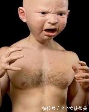 基因变异|一家三口相貌变成巨婴,是基因变异还是逆龄生长,原来是这个原因