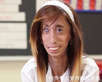 纪录|曾破吉尼斯最瘦纪录的骷髅女孩，只有27公斤，如今成励志女孩