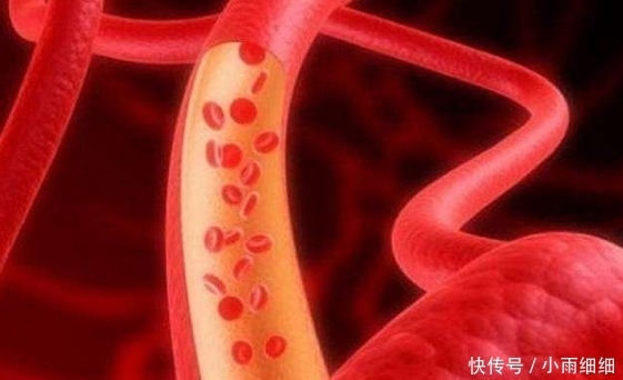 人到中年|人到中年血管最怕“堵”,3种食物可多吃,可软化血管预防堵塞