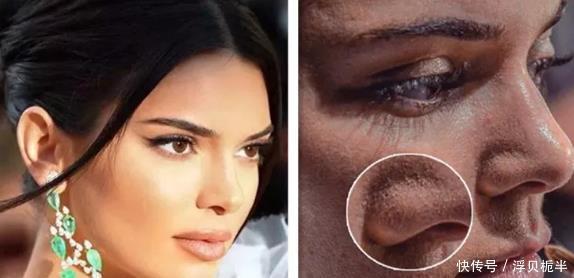 长黑头了?如何预防和去除黑头,使皮肤光滑明亮,看看就知道了!