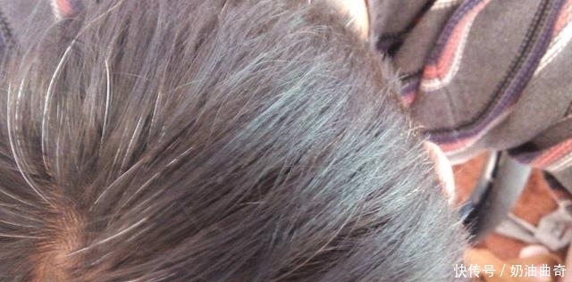 白头发|人的头发为什么会变白?不一定是年龄,知道这几点之后让你白变黑