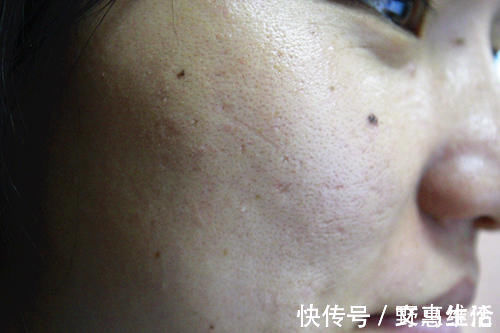 皮肤状态|运动，与不运动的人，10年以后，差距会有多大？答案来了