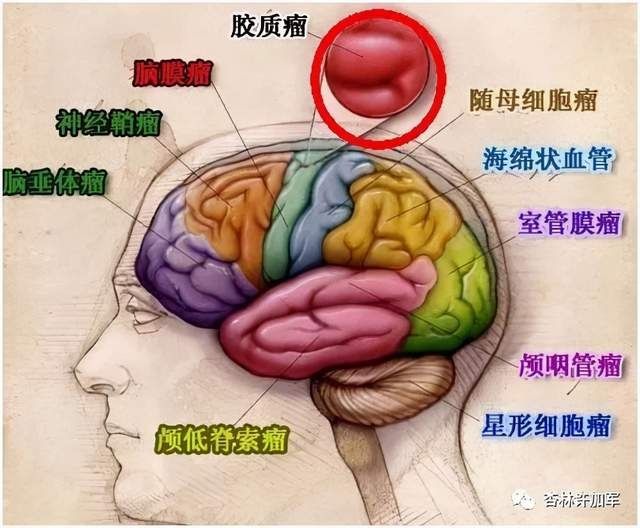 科普|科普｜神经外科你需要知道的那些疾病