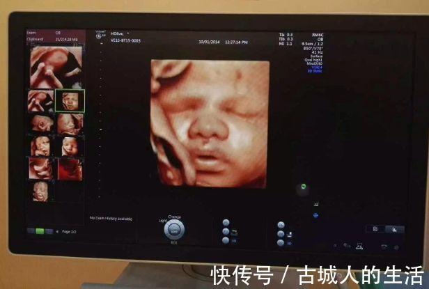 小宝贝|产检单上如果出现3个“信息”迎接准爸“小情人”吧,赶快看一下