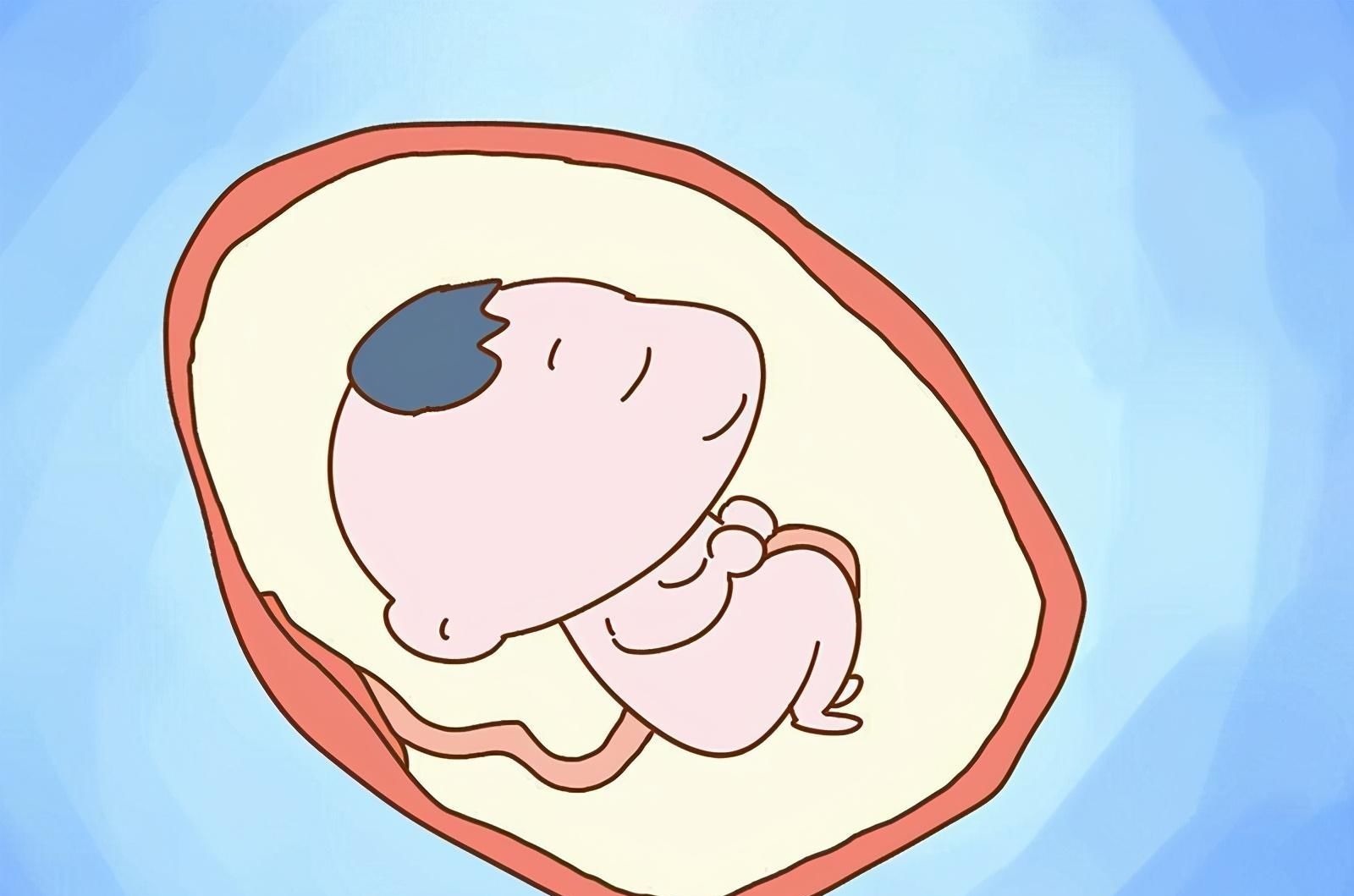 胎盘|怀孕两个月,肚子像其他人怀孕四个月一样,是什么原因?