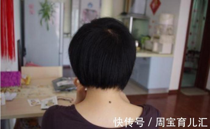 腋窝|怀孕时身体这4个部位变黑了?孕妈别着急,这是宝宝健康的表现