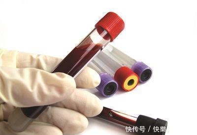 血液粘稠|血液粘稠的人,身体有这4种表现,养血管,谨记饭后“三忌”!