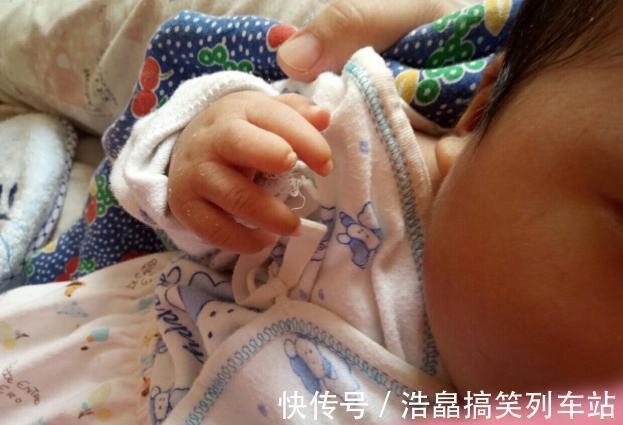 双胞胎|双胞胎被查出“畸形”,准妈妈不顾劝阻坚持生下,是自私还是母爱