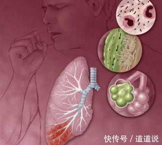 阻塞性|肺气肿病发的原因是什么?