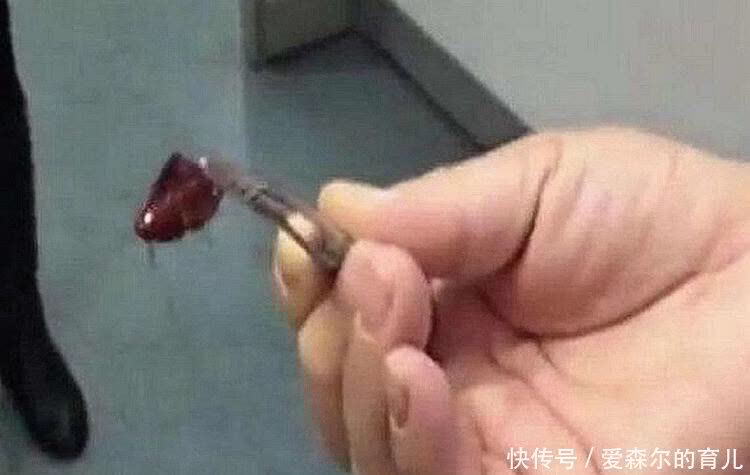 孩子|娃耳朵进虫子，妈妈果断地处理方式救了孩子的听力，连医生都夸赞