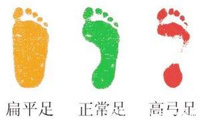 鞋底|给孩子买鞋别只看颜值,穿得不对影响脚部发育不说,还有健康威胁
